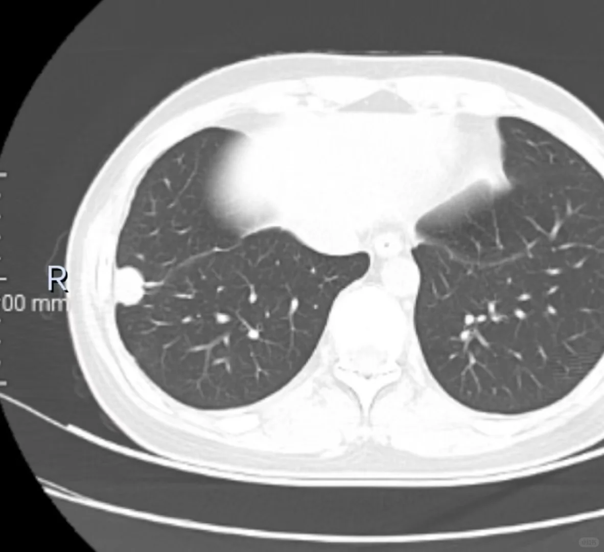 出院啦，惊喜，还有28天✨