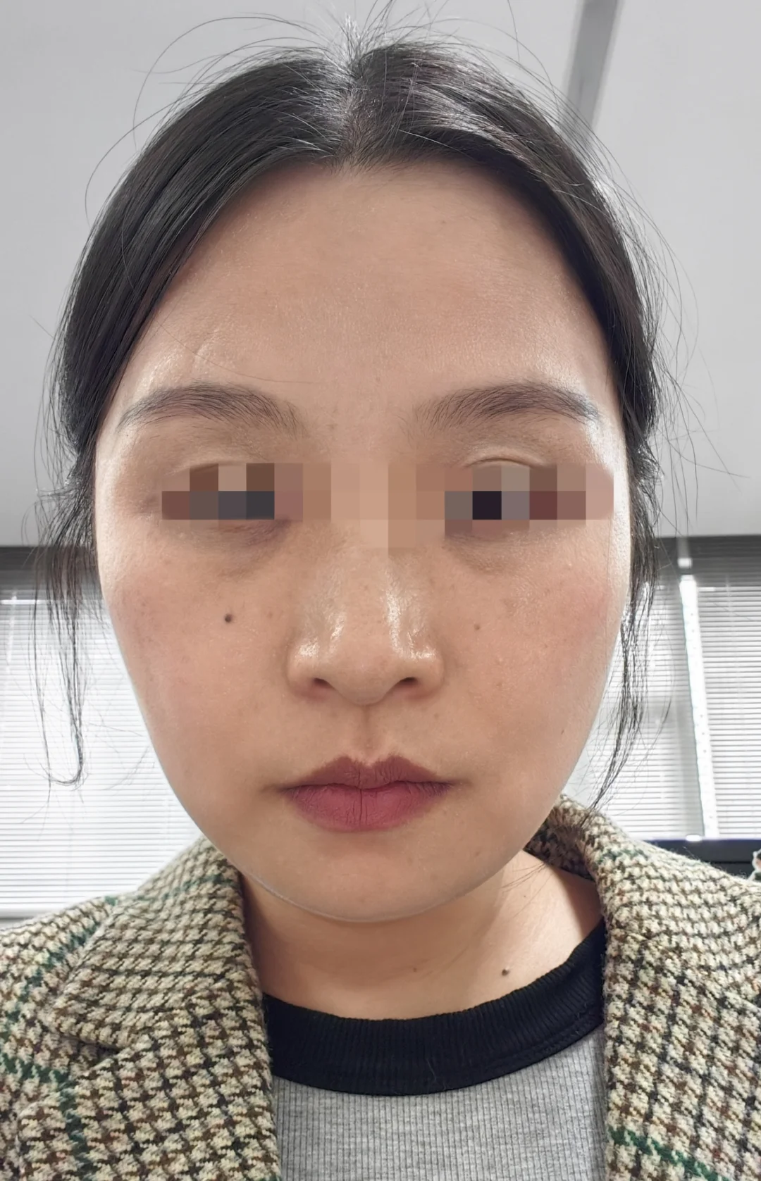 四十一岁无美颜