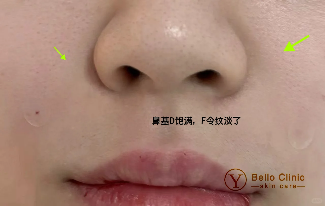 女明星们的这俩条线～