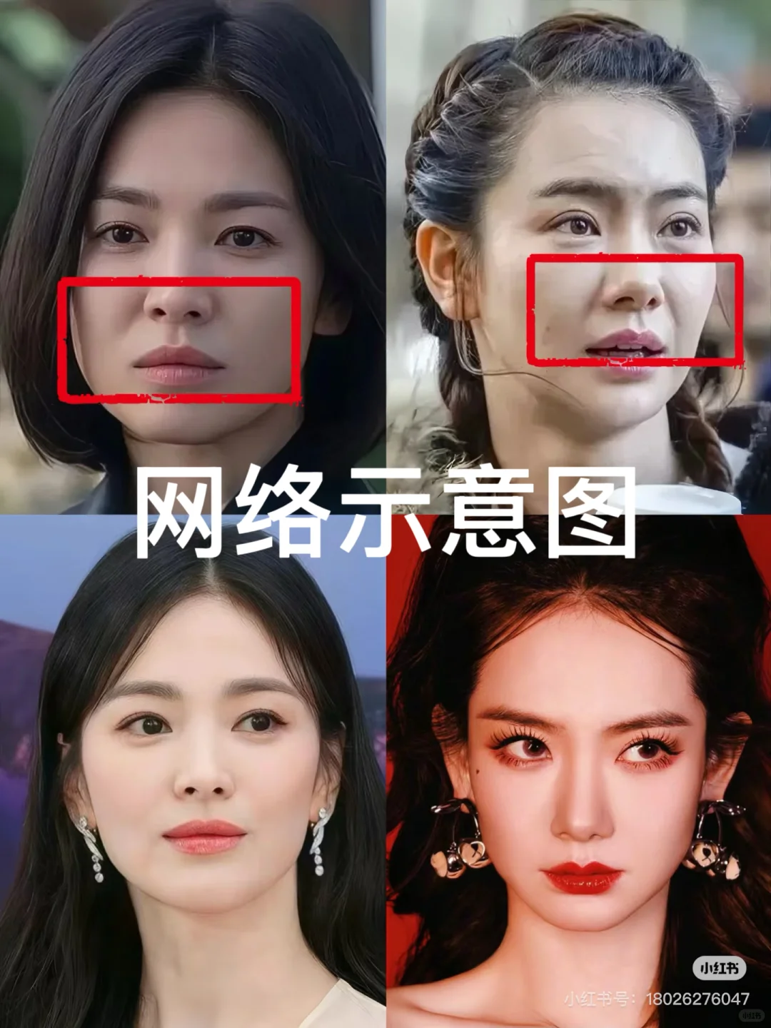 女明星们的这俩条线～