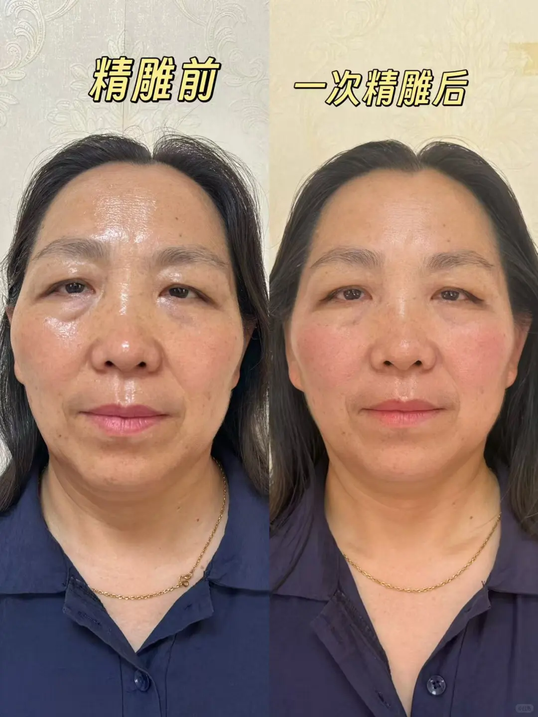 面部精雕，安全可靠