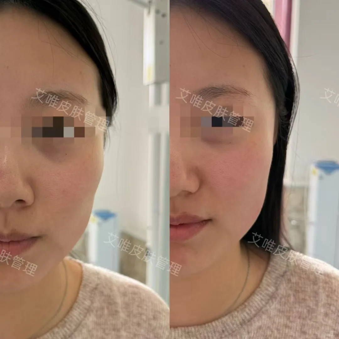 大同小姐姐改善面部轮廓