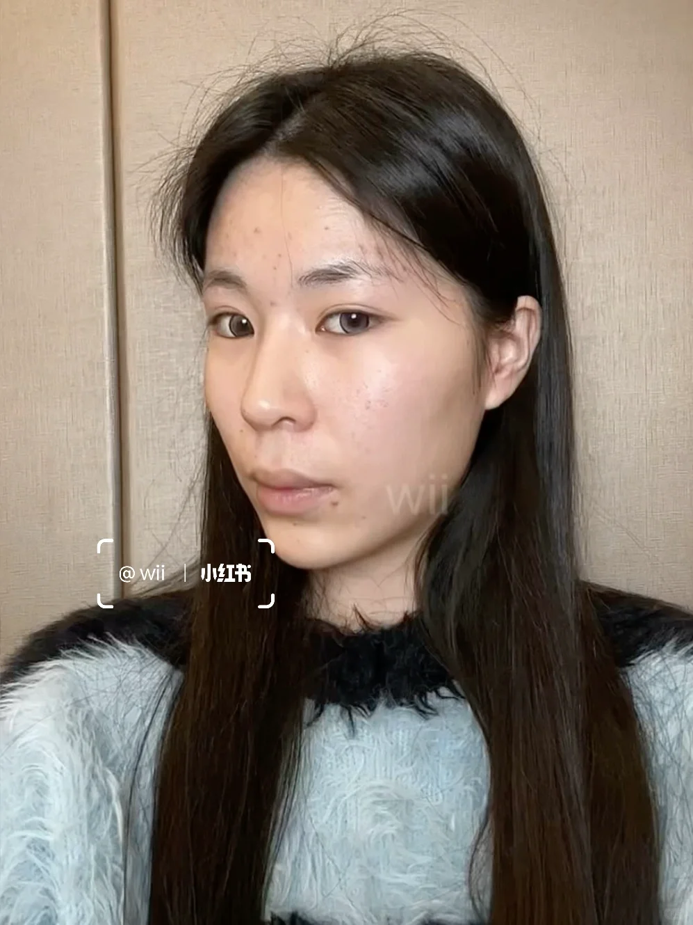 三件套后 感觉面相都变了