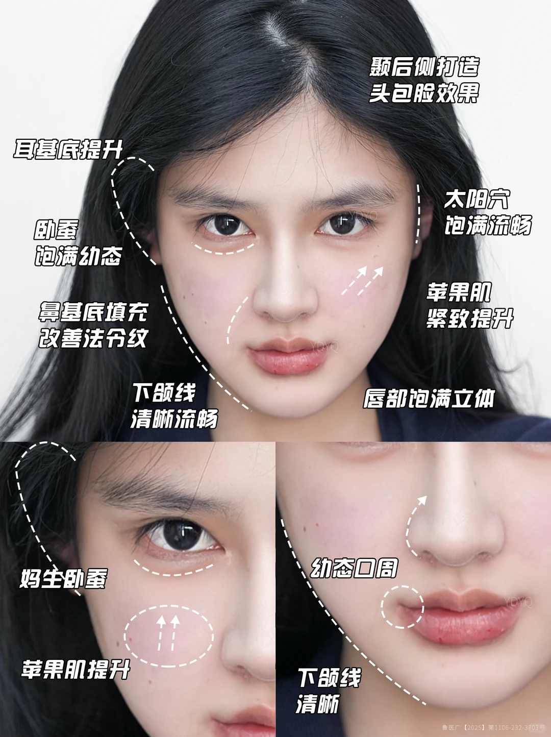 不到3k打造幼态脸！山东微调抗衰圣手含金量
