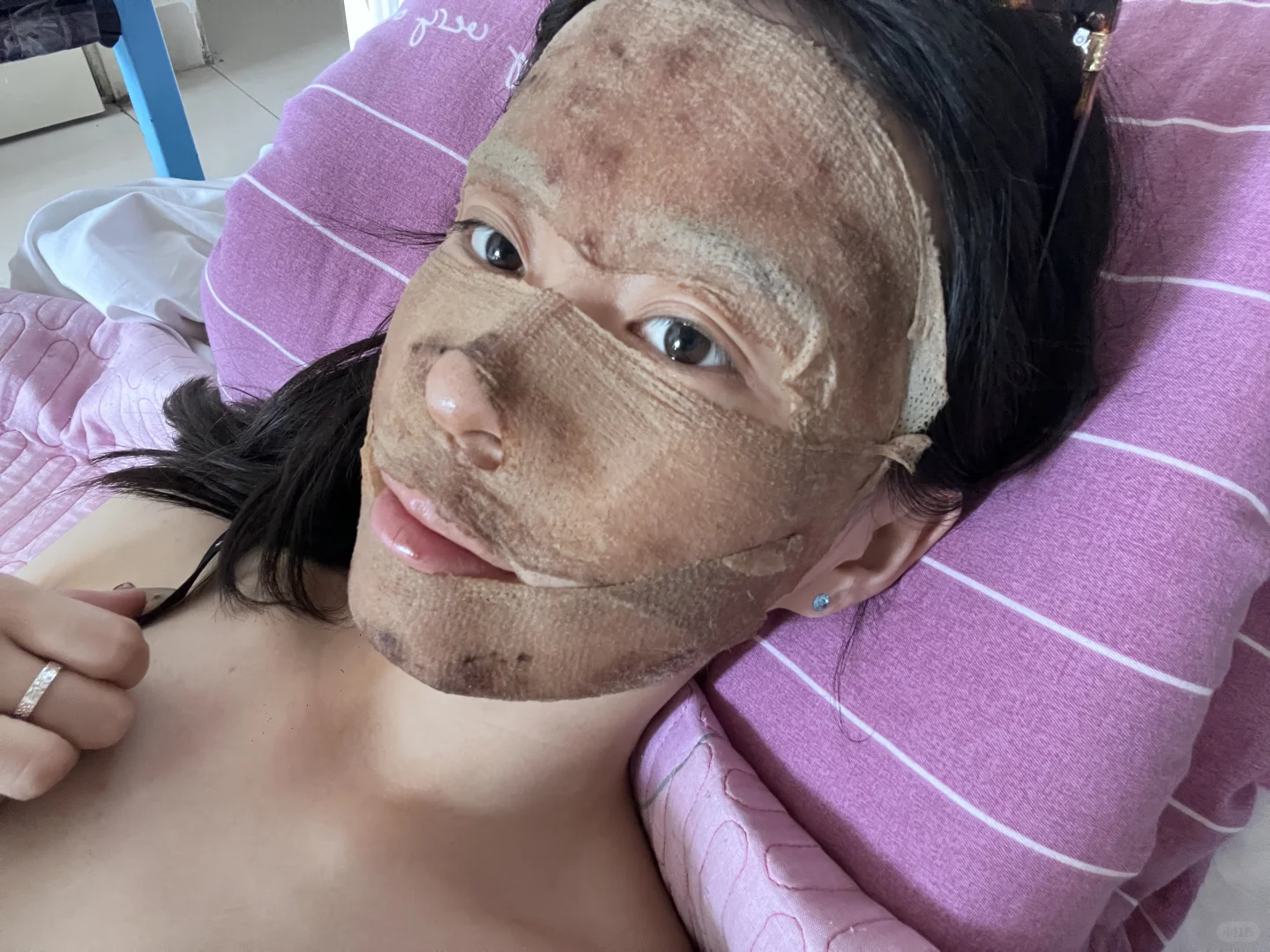 如果不长痘我的人生该多灿烂