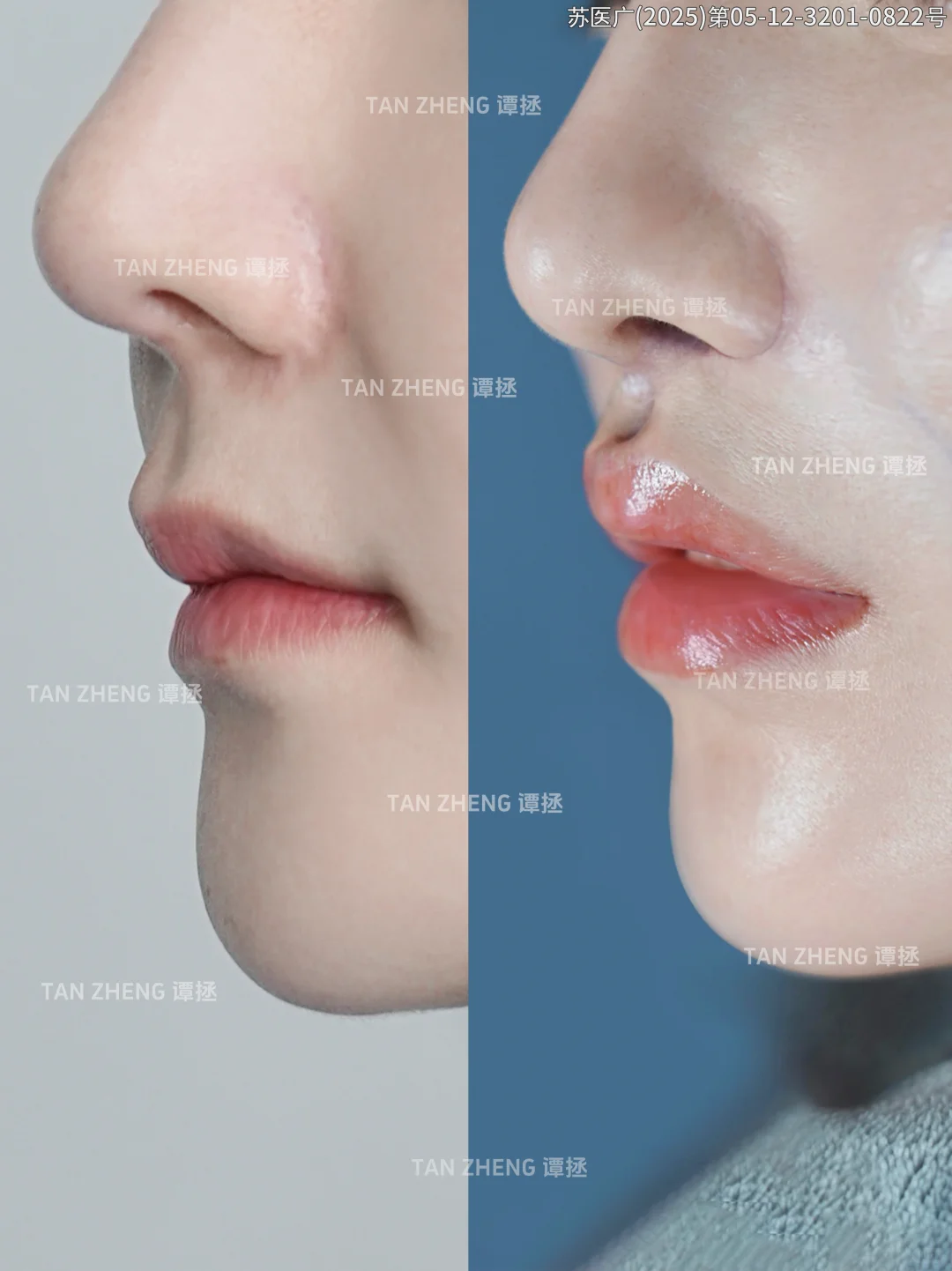 该怎么来形容啊 这个人中💧水滴窝窝真美