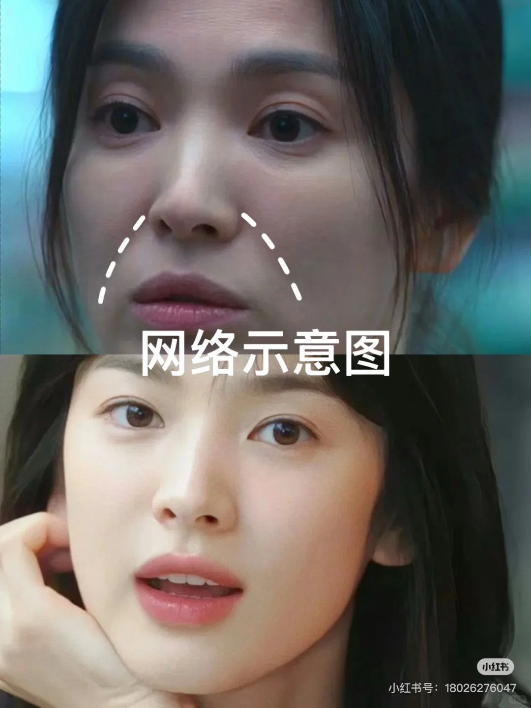 女明星们的这俩条线～