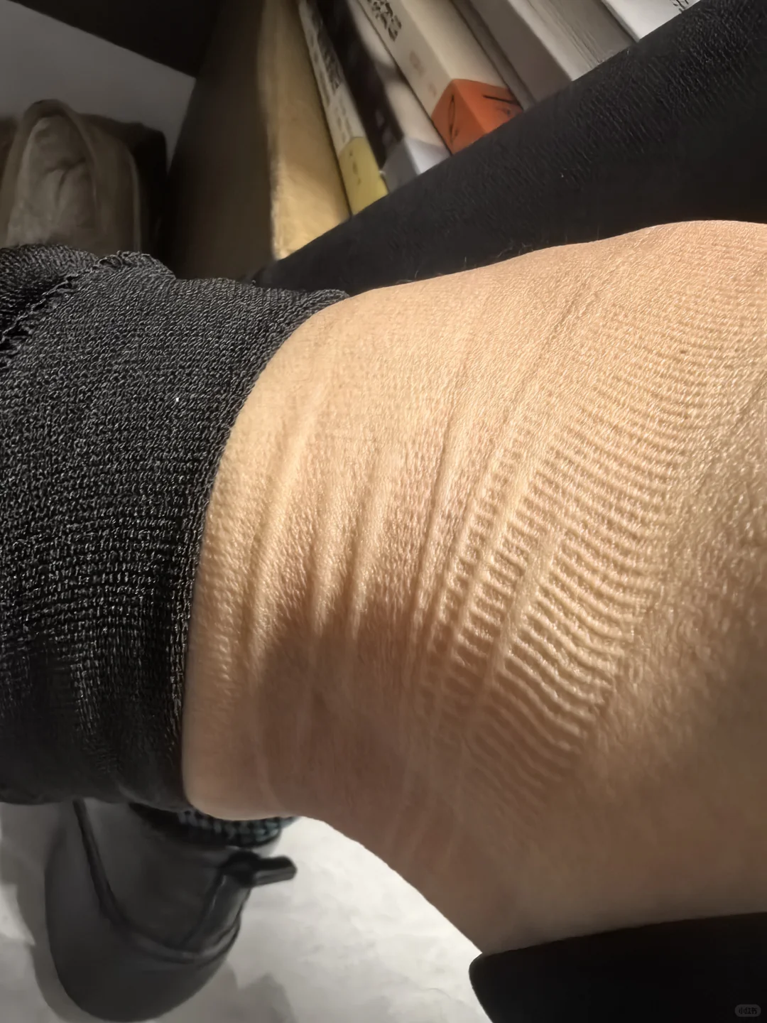 过膝压力袜不要日常穿