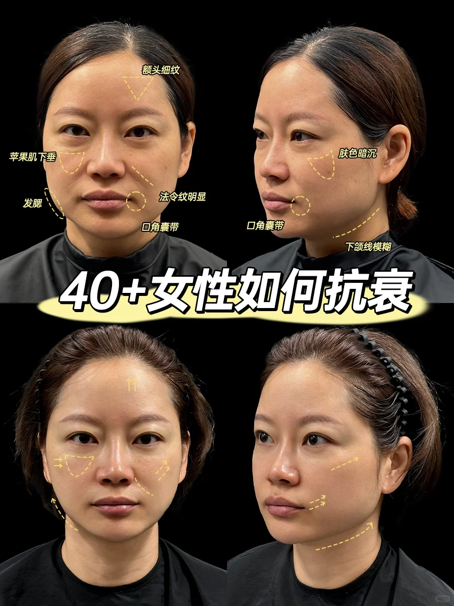 40+女性抗衰方案