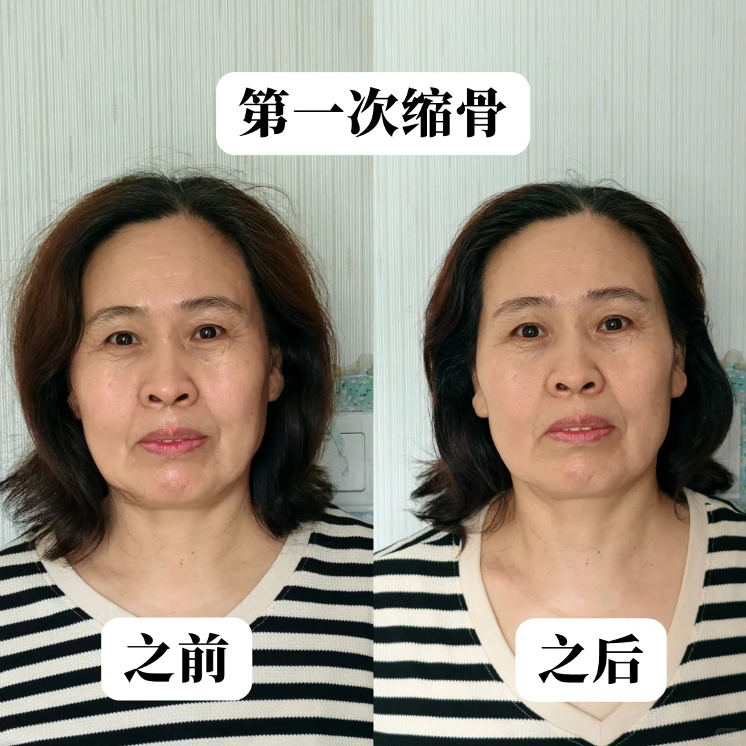 真实案例：变美不是梦‼️