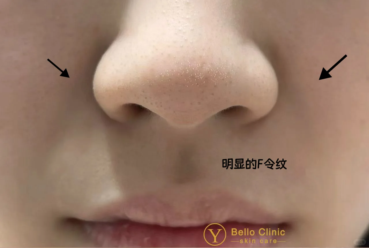 女明星们的这俩条线～