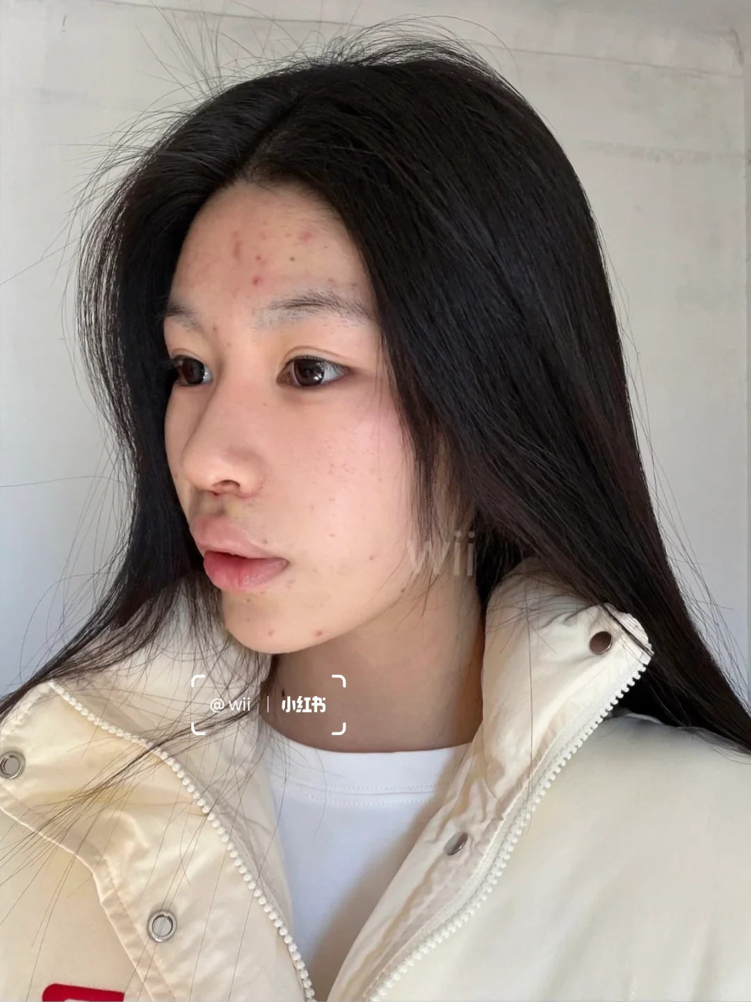 三件套后 感觉面相都变了