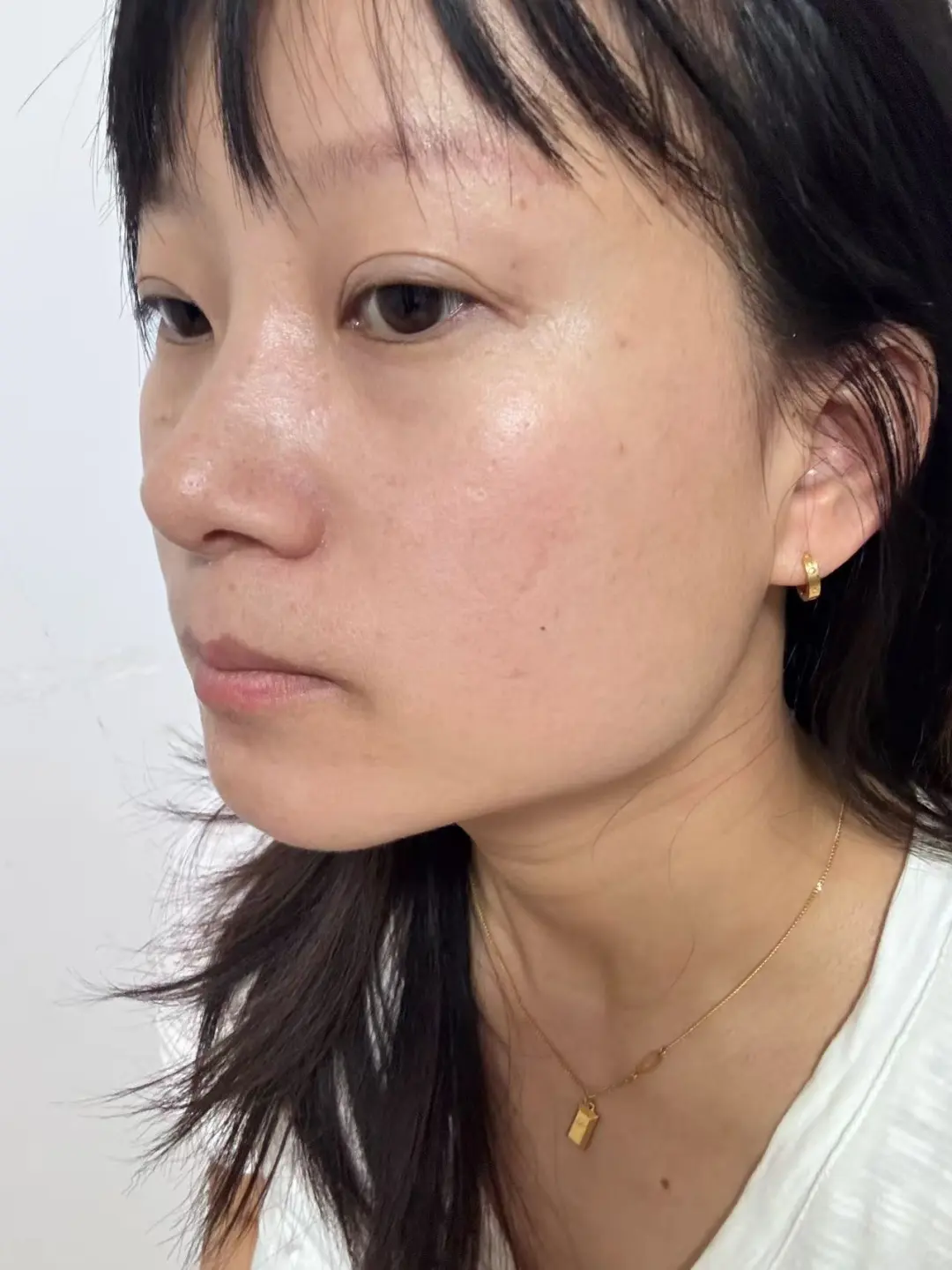 天津方圆脸瘦脸针一个月。。