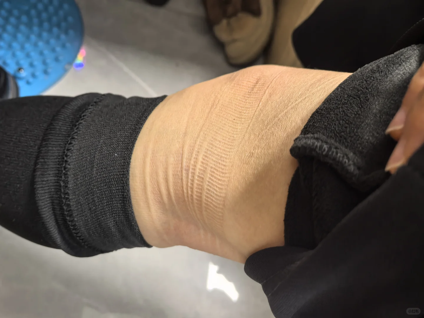 过膝压力袜不要日常穿