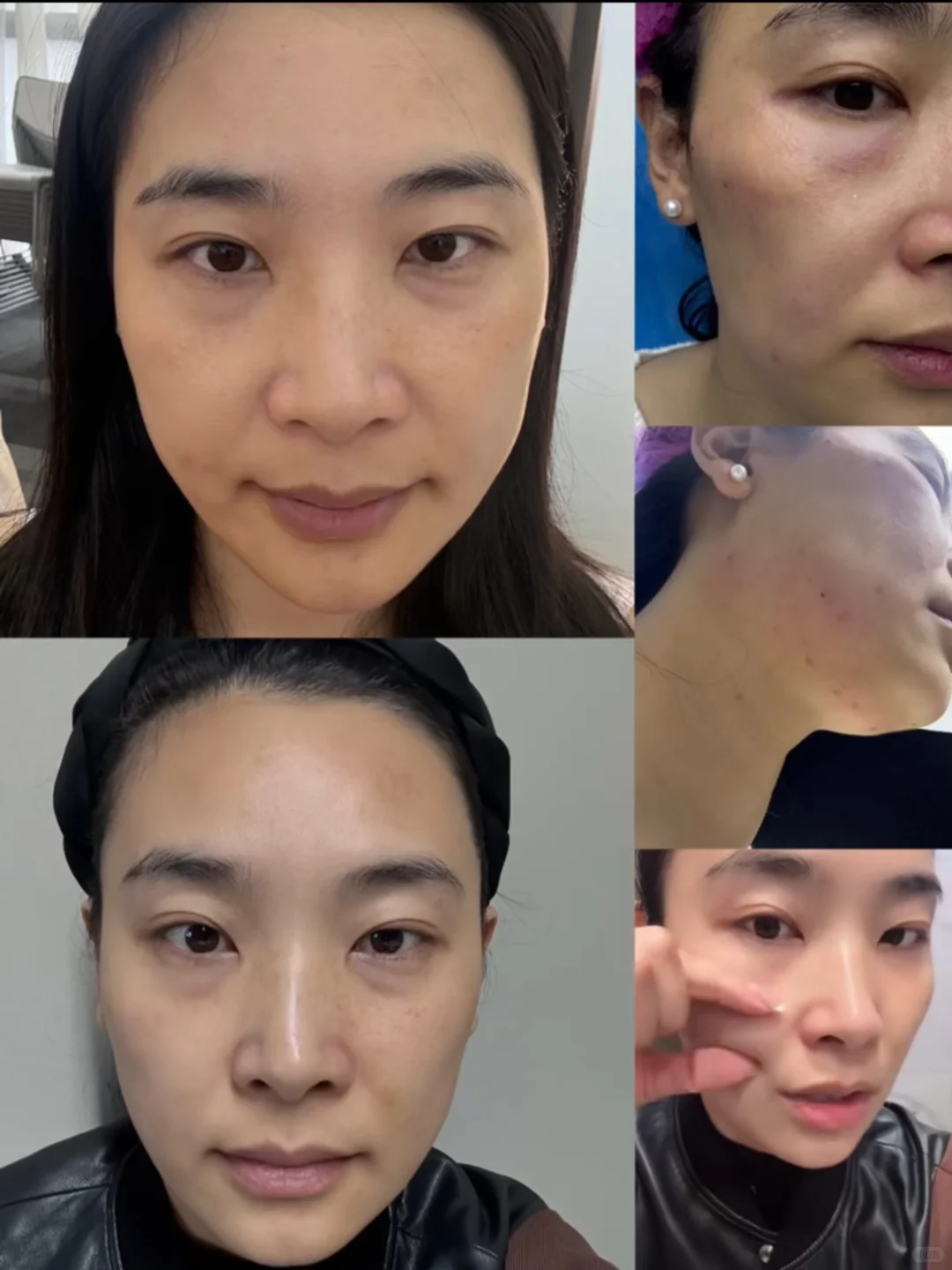 很多人不理解，为什么没填充面部也馒化了呢？