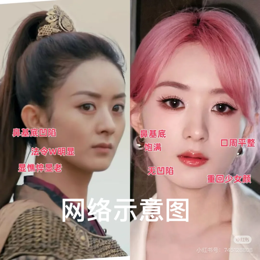 女明星们的这俩条线～