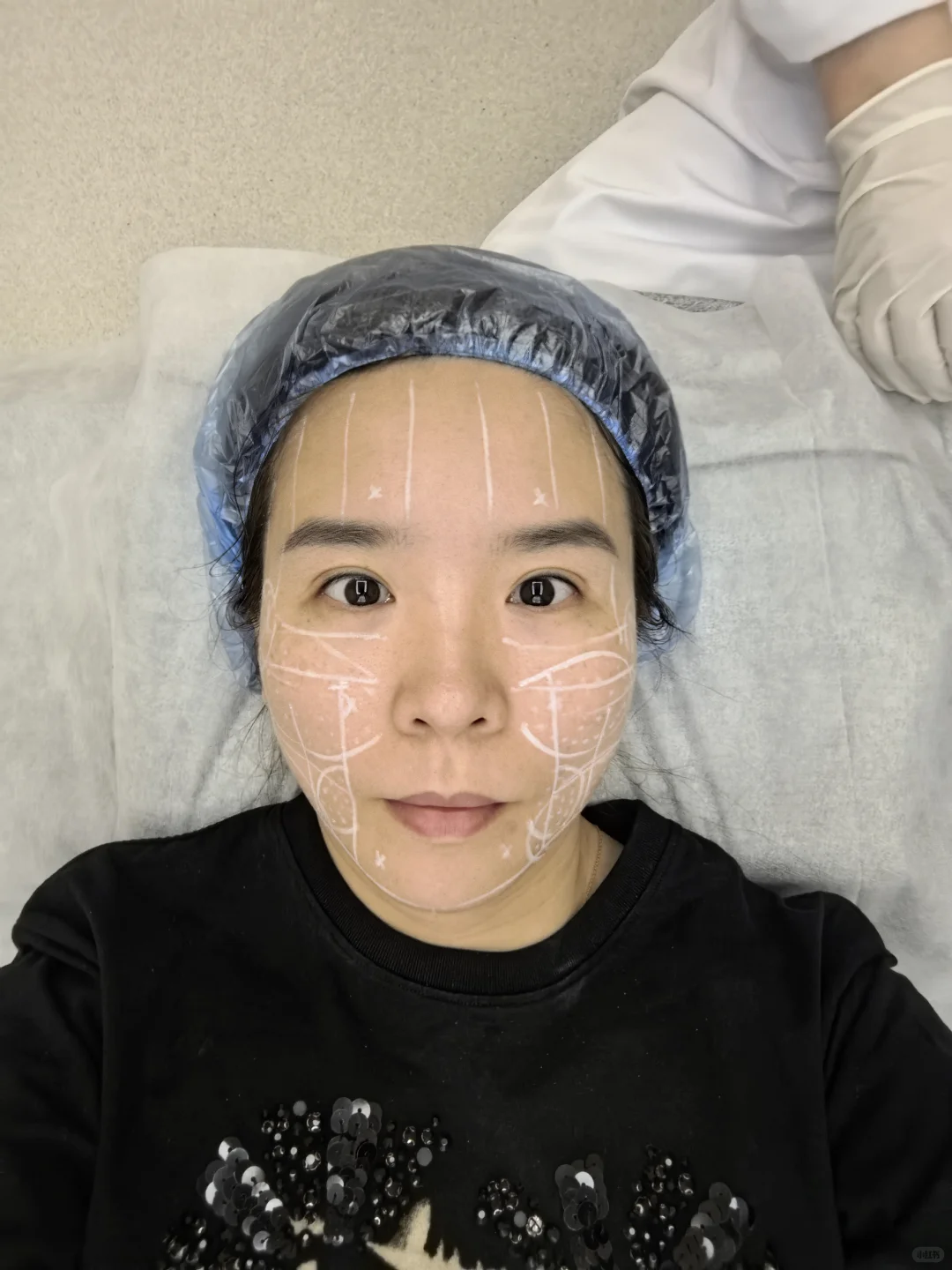 美拉美超声刀 mark一下