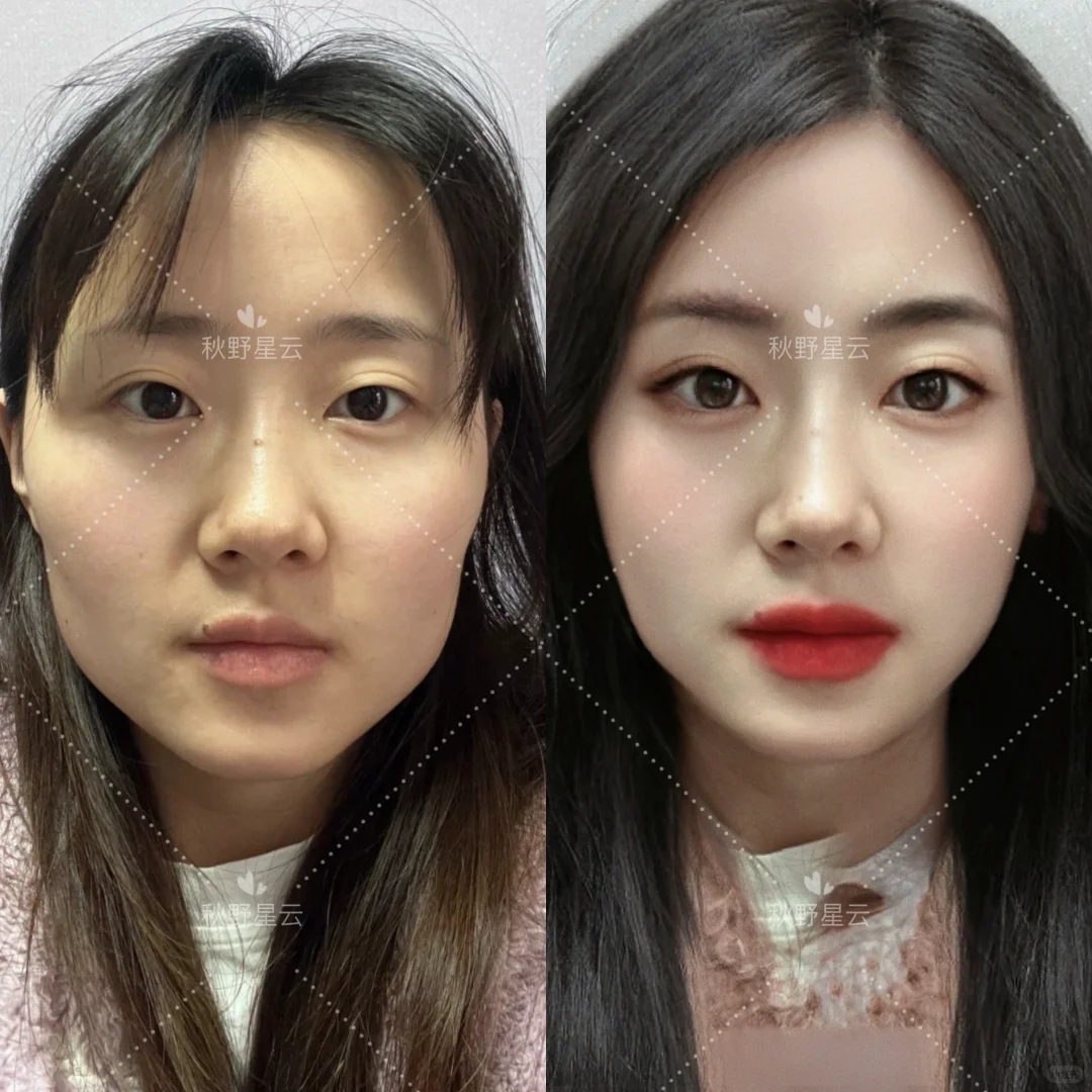 🌱脸型变美思路1：大方脸/方圆脸/阔面脸