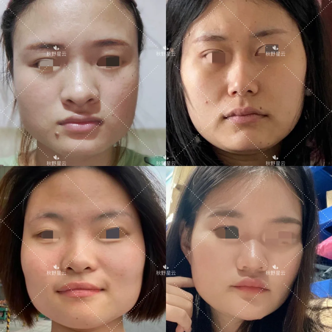 🌱脸型变美思路1：大方脸/方圆脸/阔面脸