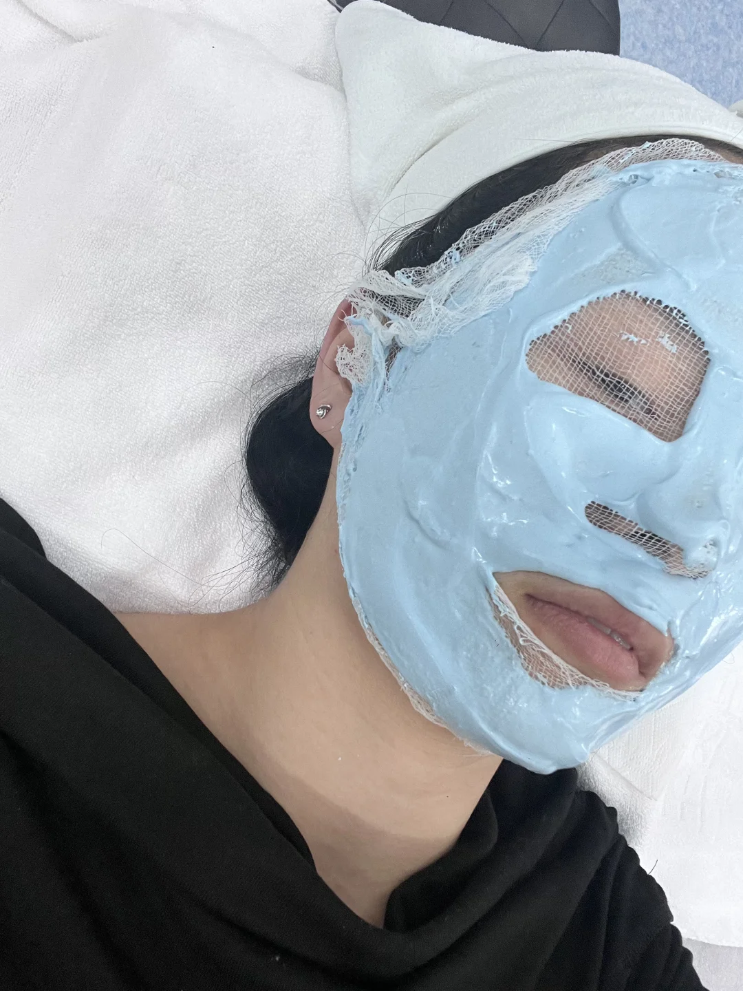 如果不长痘我的人生该多灿烂