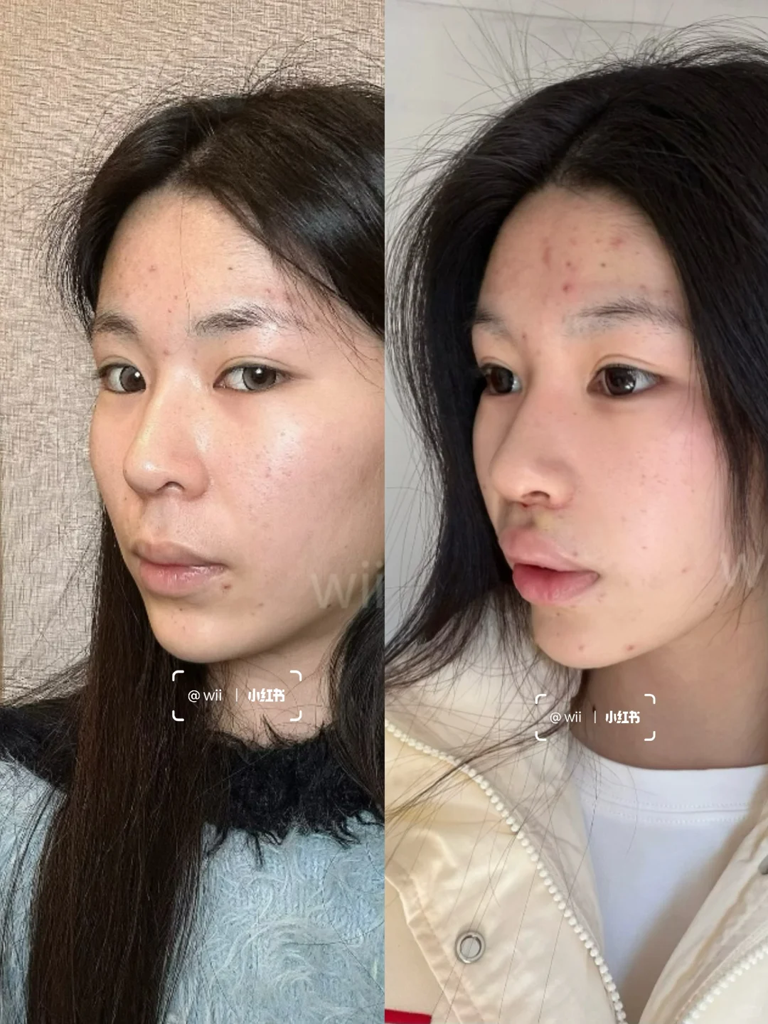 三件套后 感觉面相都变了