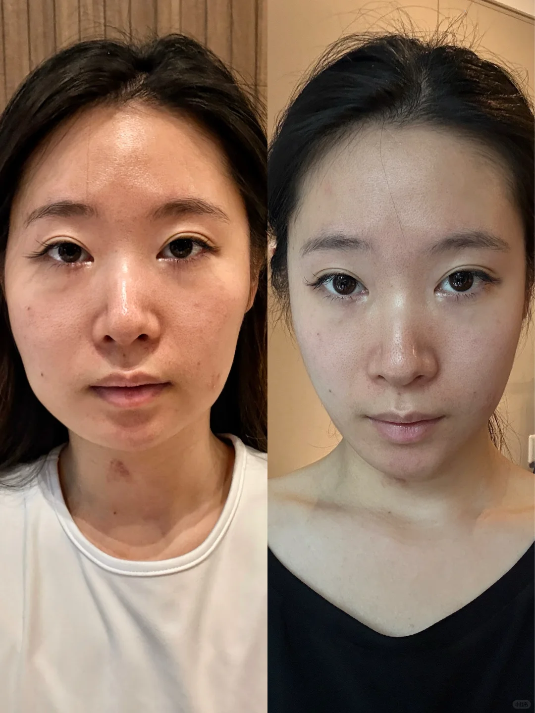 去馒➕提升 轻薄脸轻松get‼️