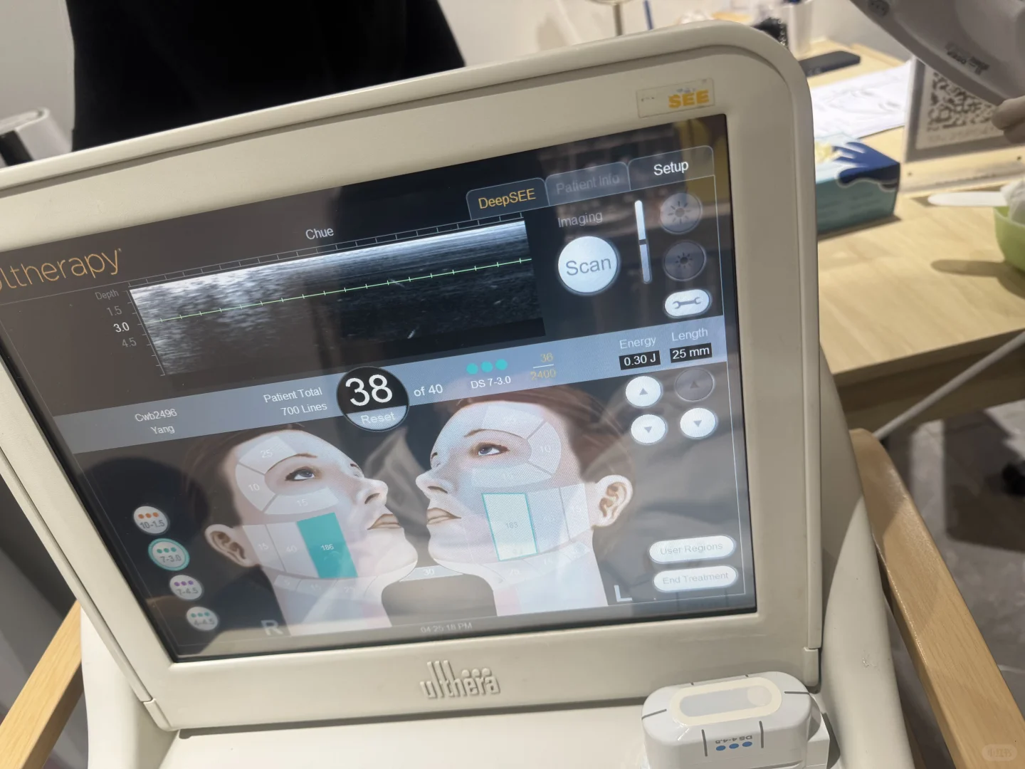 香港美版超声刀美神针安排