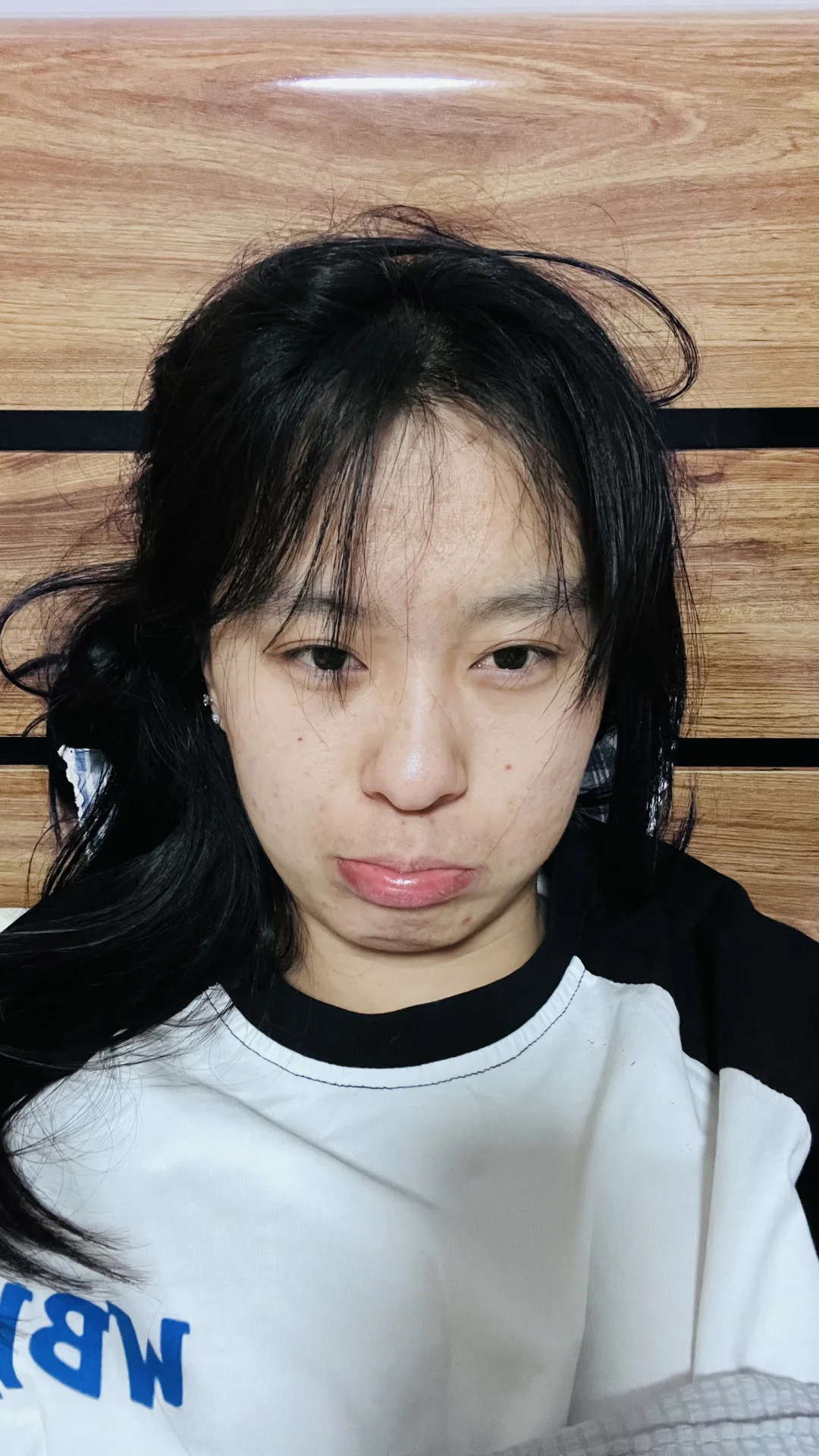 如果不长痘我的人生该多灿烂