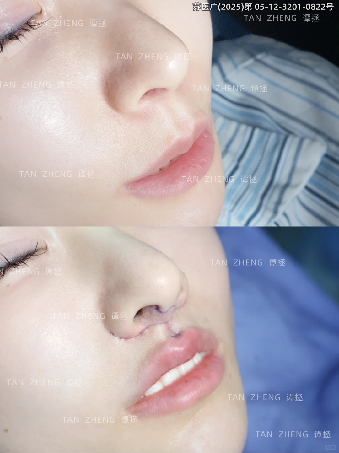 该怎么来形容啊 这个人中💧水滴窝窝真美