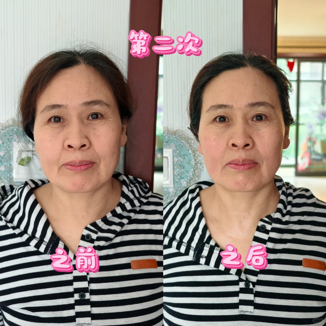 真实案例：变美不是梦‼️