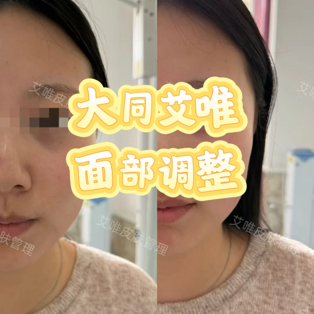 大同小姐姐改善面部轮廓