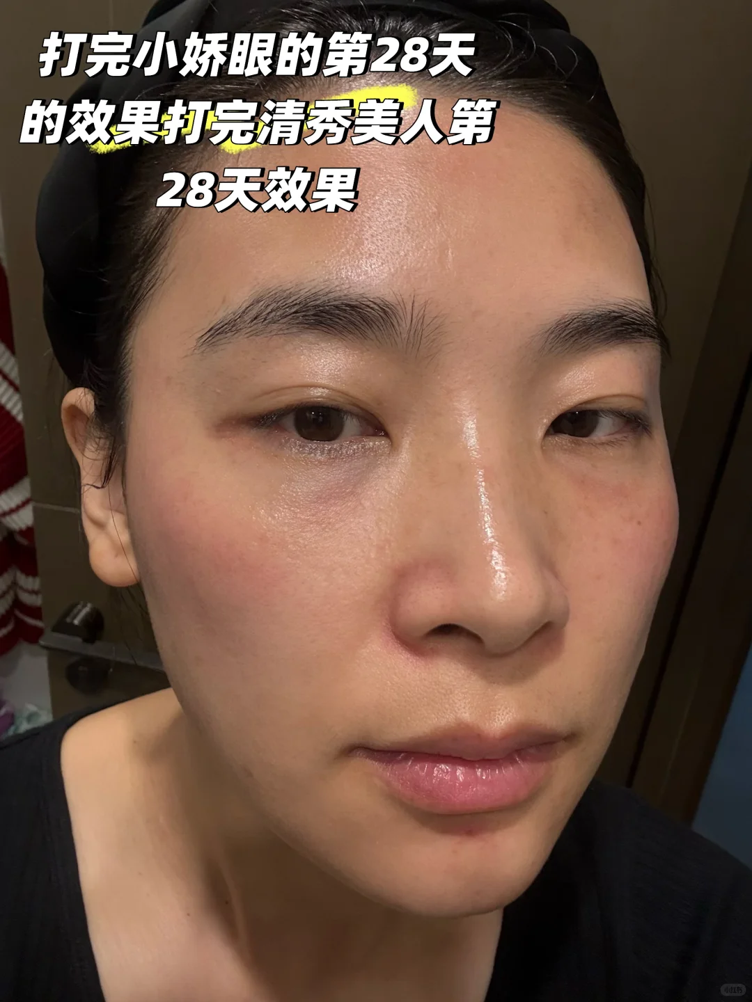 很多人不理解，为什么没填充面部也馒化了呢？