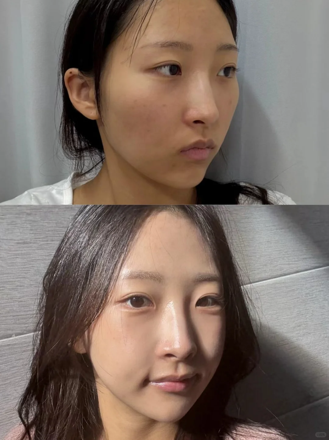 脸型真的比五官更决定颜值✨