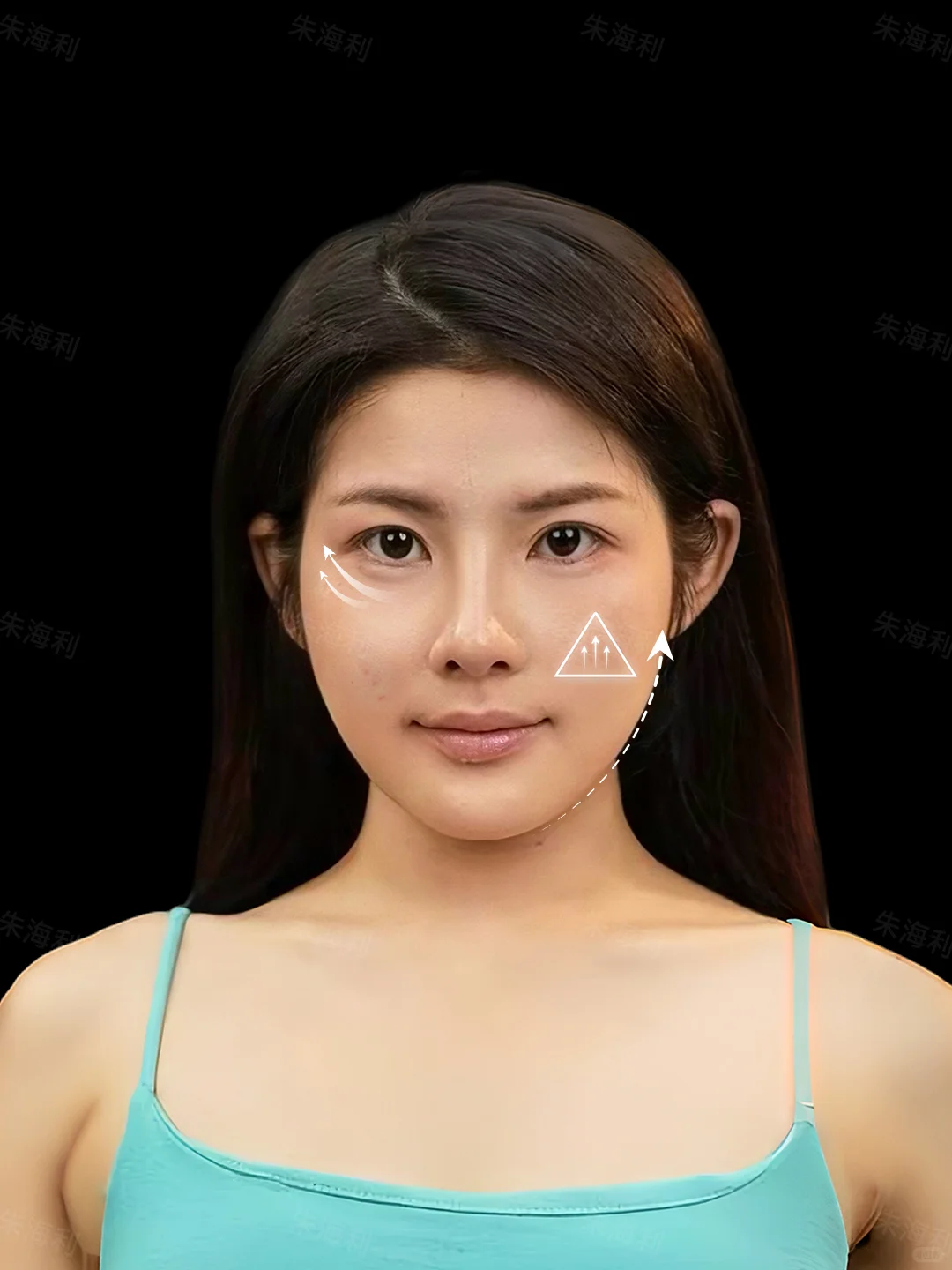 肉肉方圆脸微调 | 少女裸妆感变美