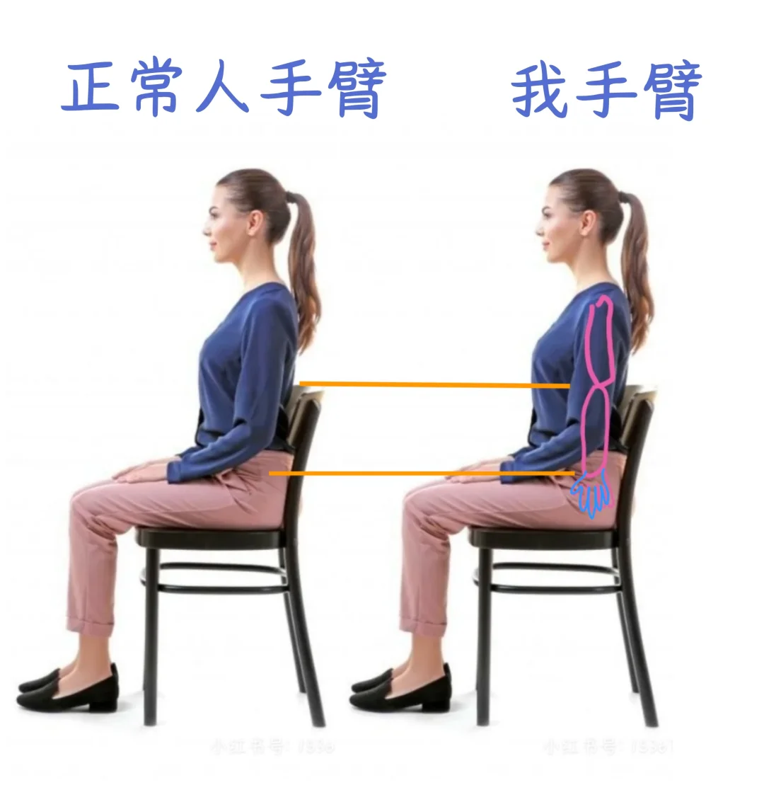 四肢短小，腰身细长