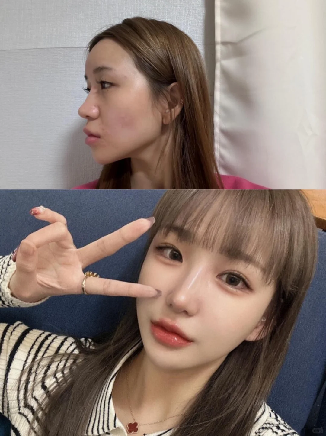 终于悟了！脸型才是颜值的基石✨