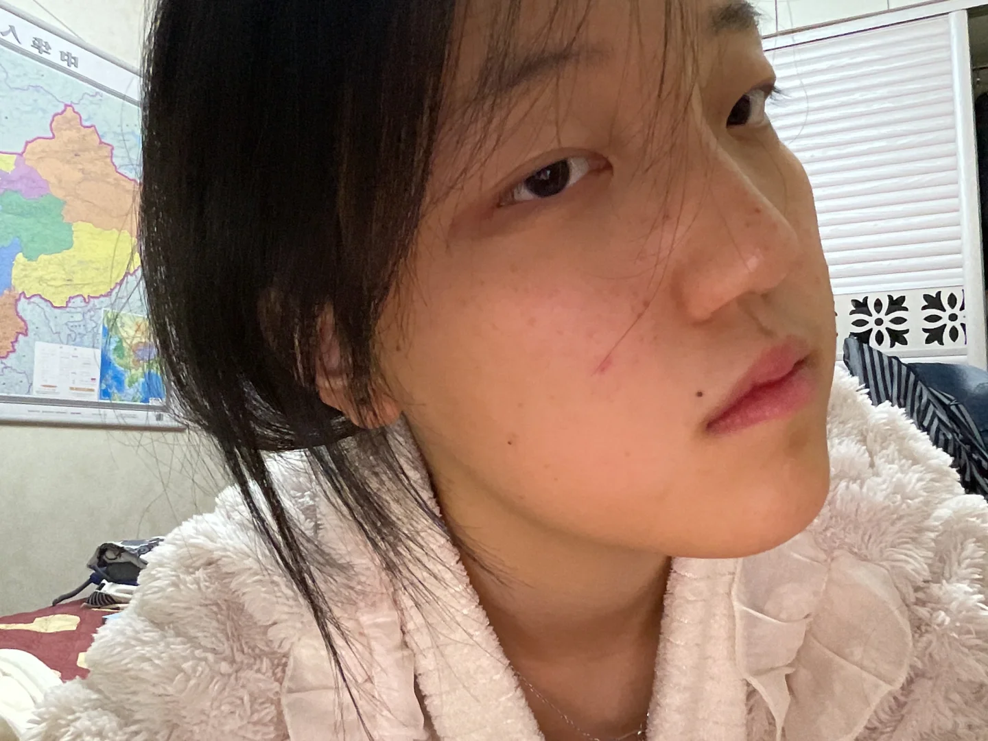 重生之全世界的颧骨都长在我脸上