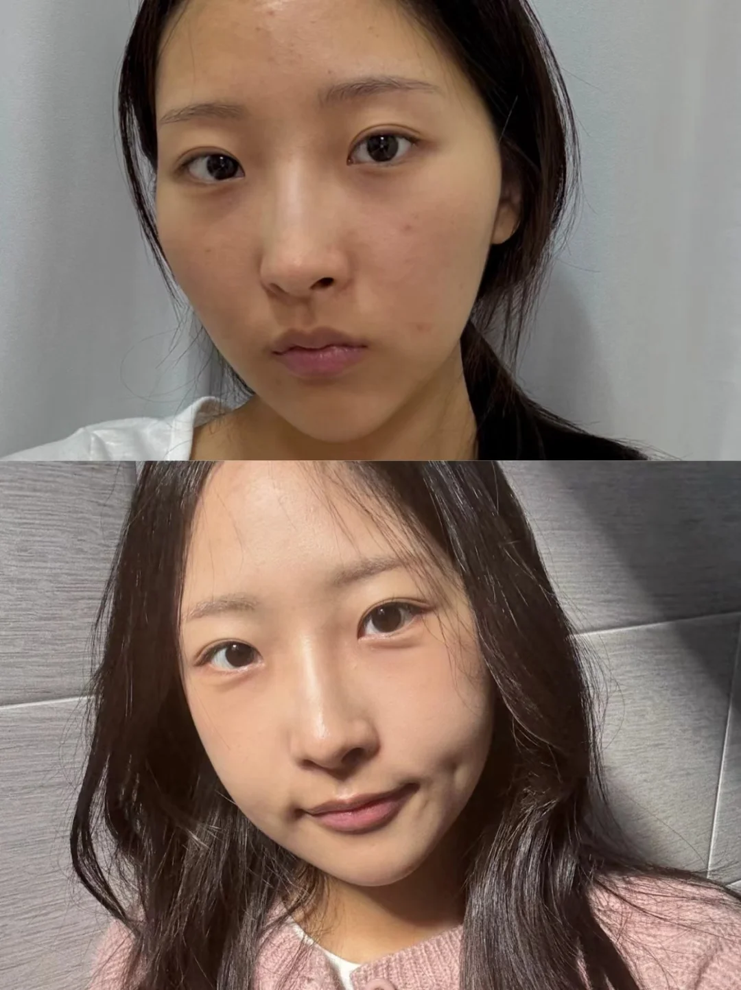 脸型真的比五官更决定颜值✨