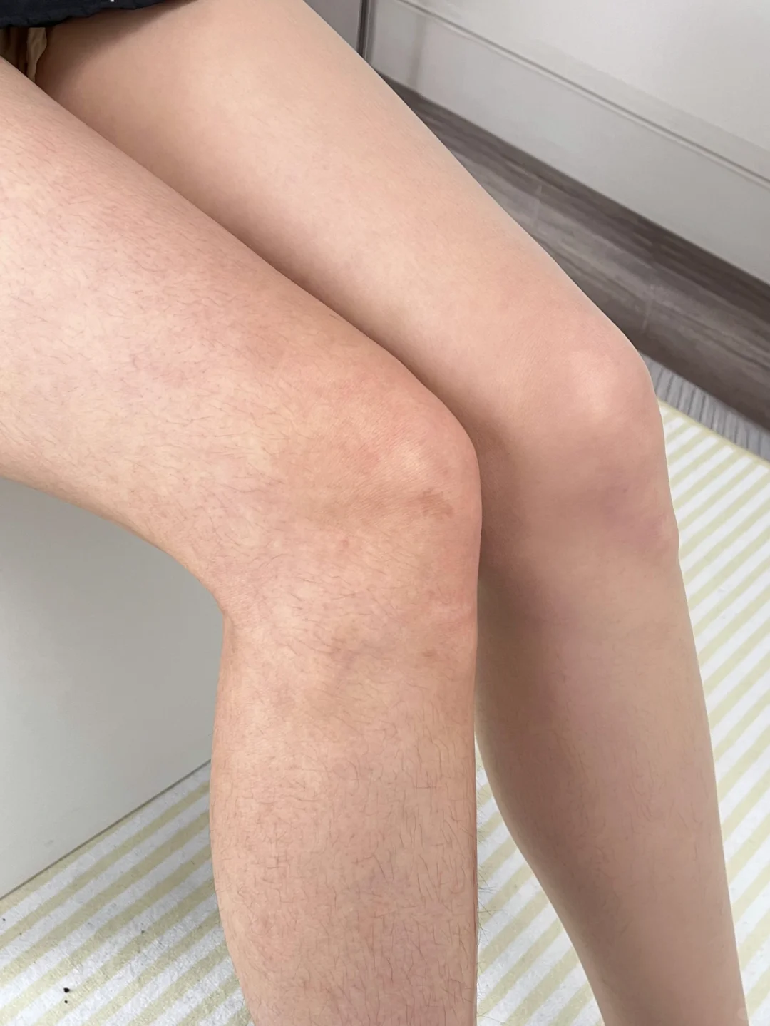 同款腿的姐妹快来啊