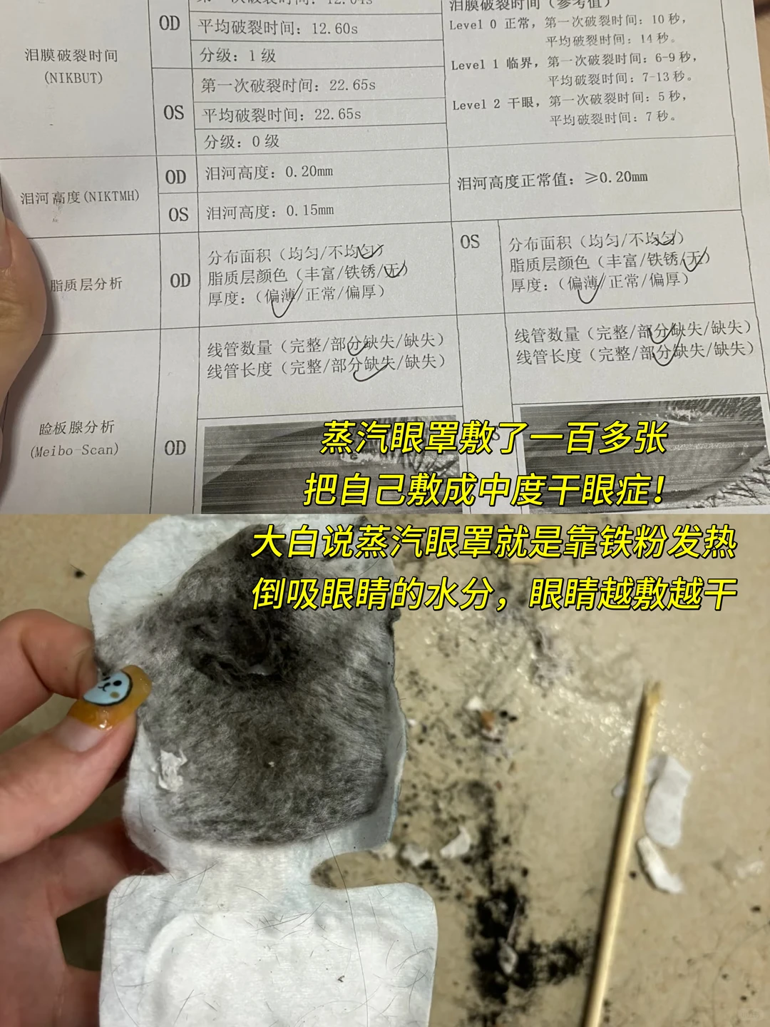 我听过最大的谎言:干眼症敷蒸汽眼罩就没事