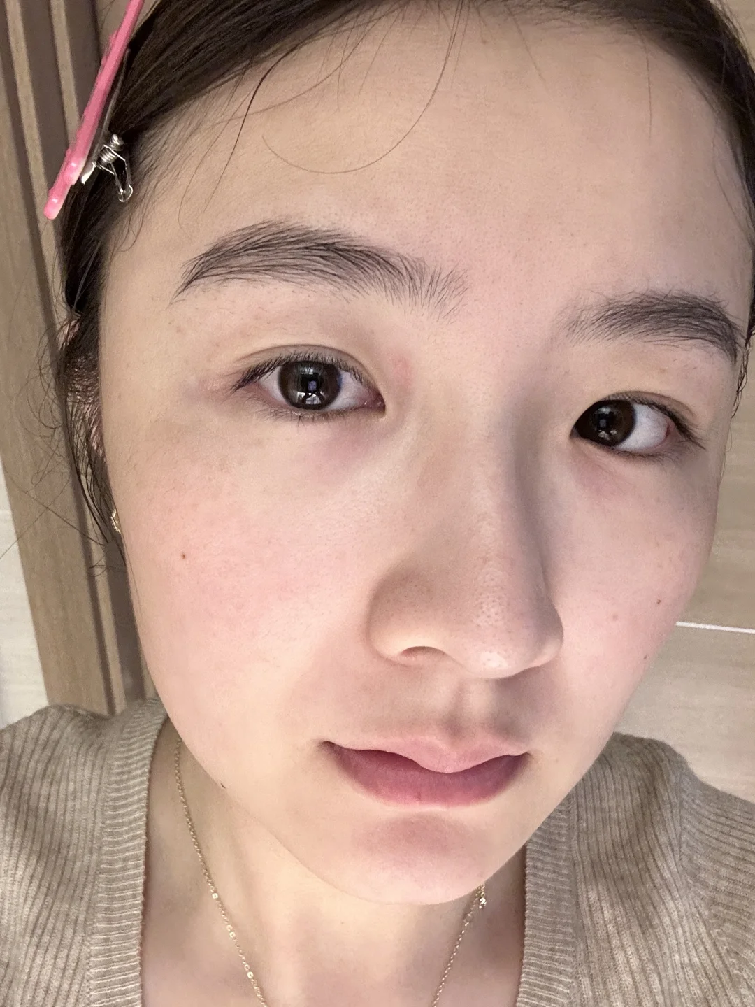 奔三的后置 好皮肤是内调出来的哦～