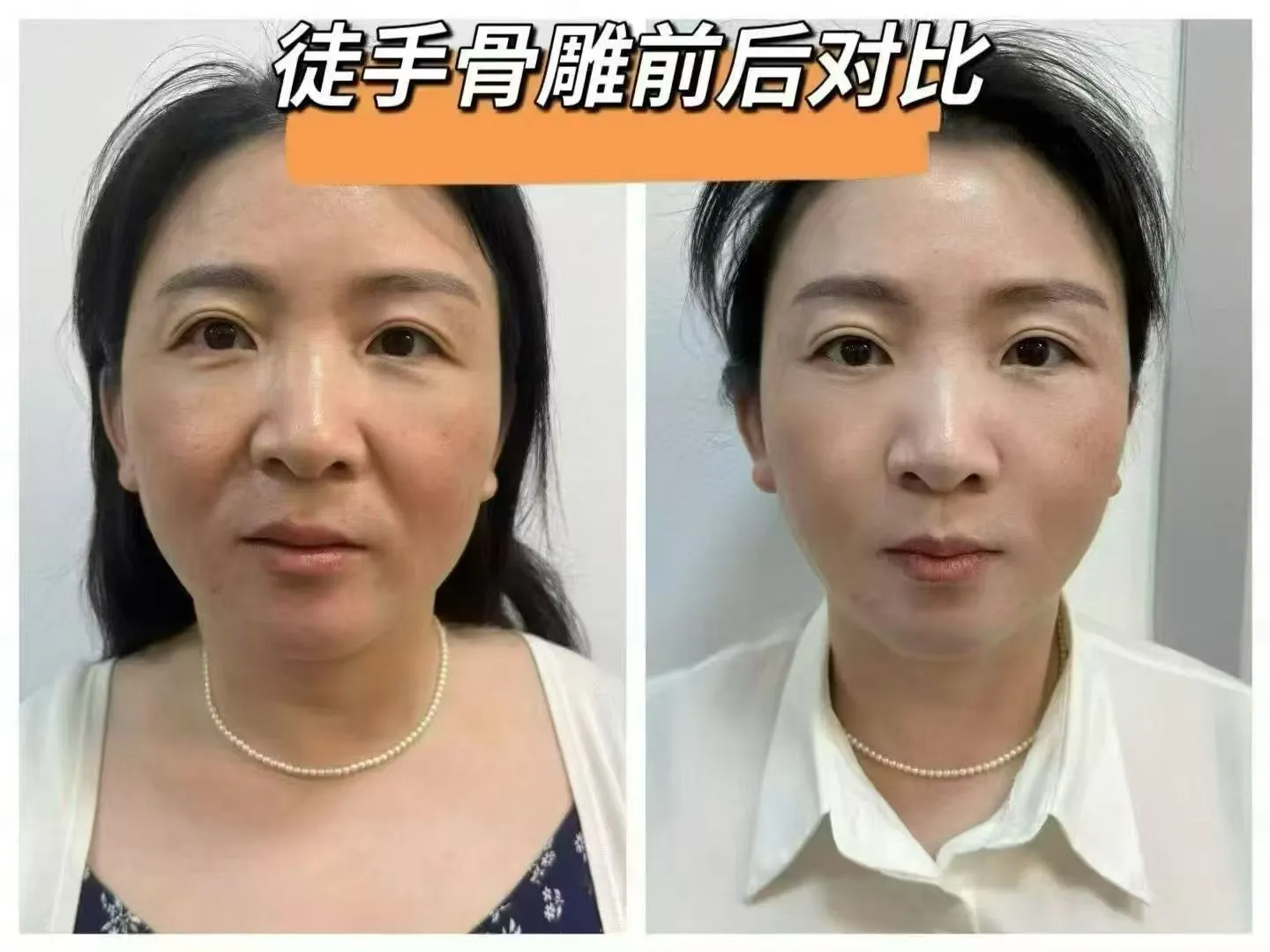 重启年轻，一起来吧