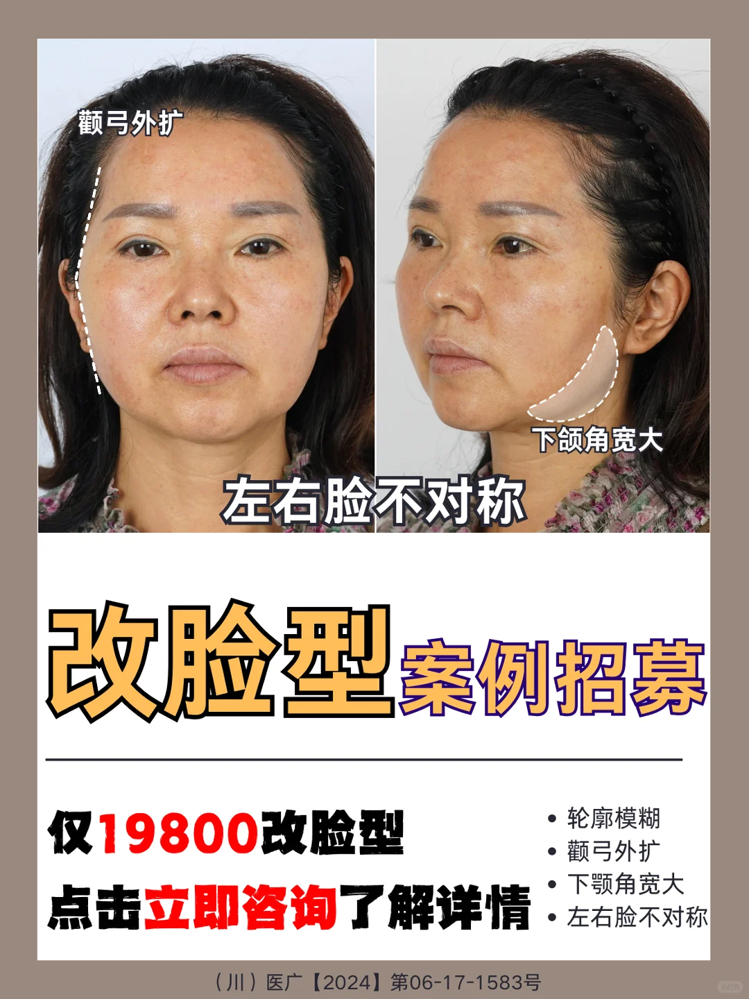 案例招募｜脸型爆改🔥