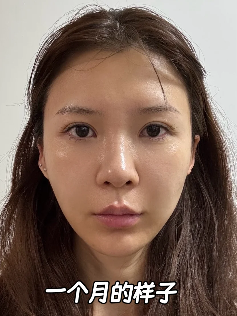 45岁被老公蛐蛐老了，花一个lv调的怎么