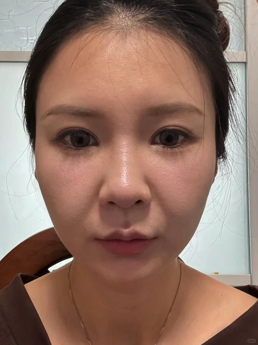 45岁被老公蛐蛐老了，花一个lv调的怎么