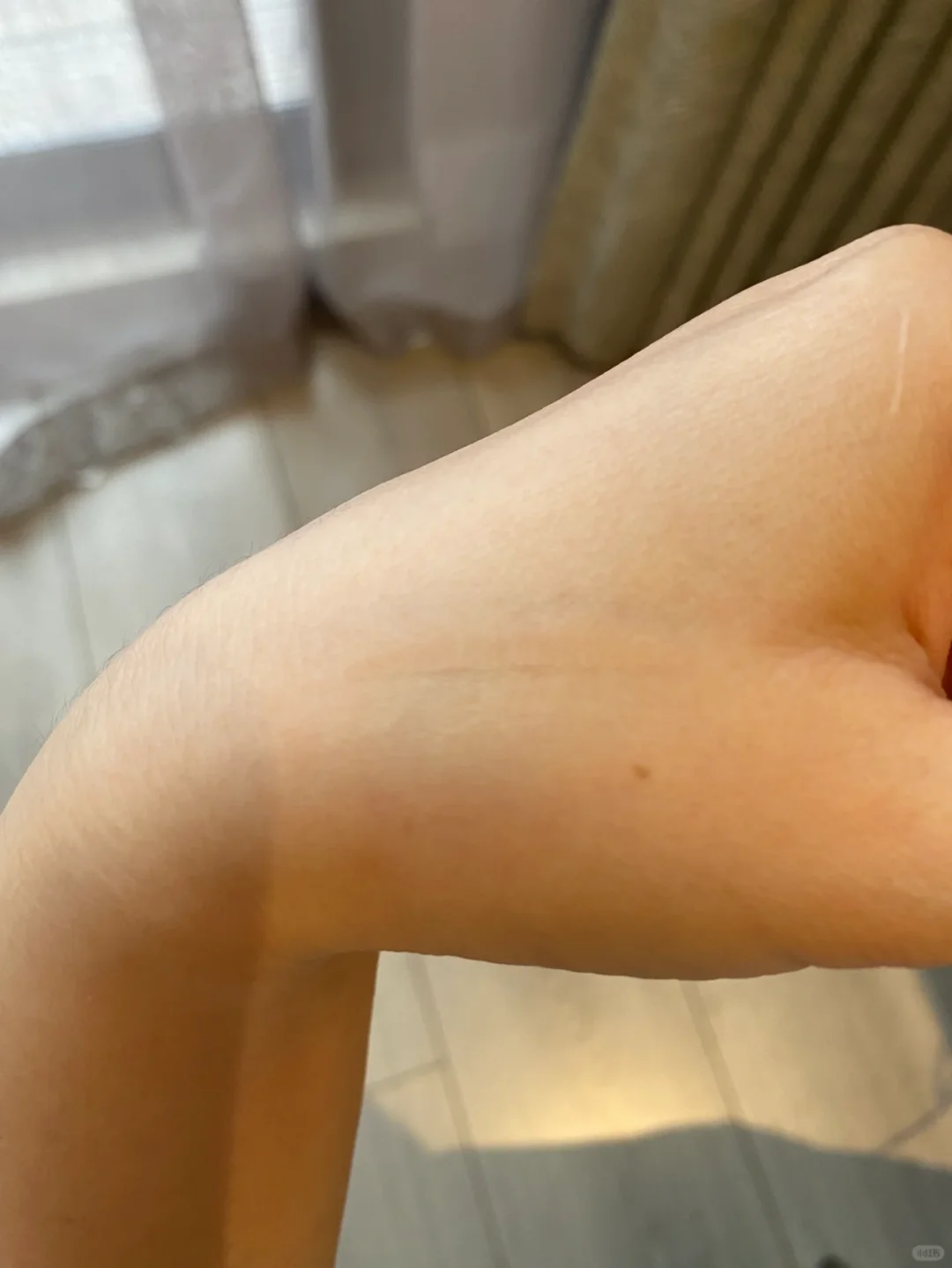 肿眼泡の消失术｜蕾丝贴出漫画眼