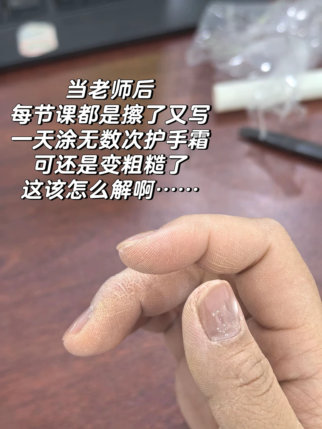 这手也是跟上我受罪了
