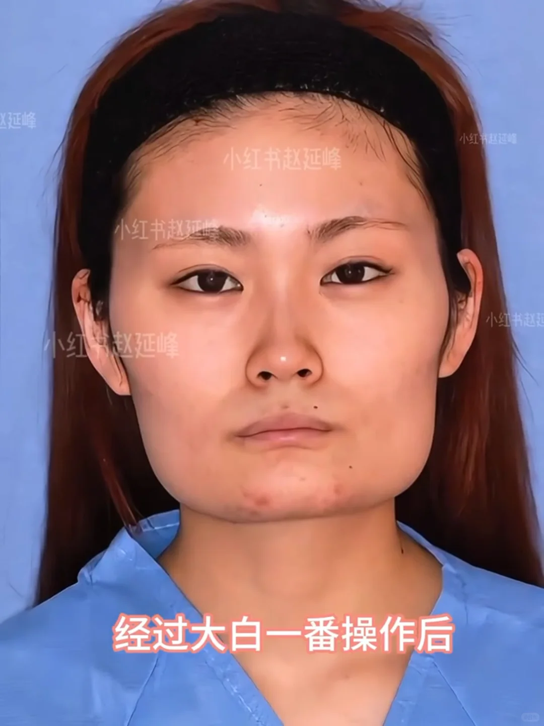 知道脸型重要，但没想到这么重要…