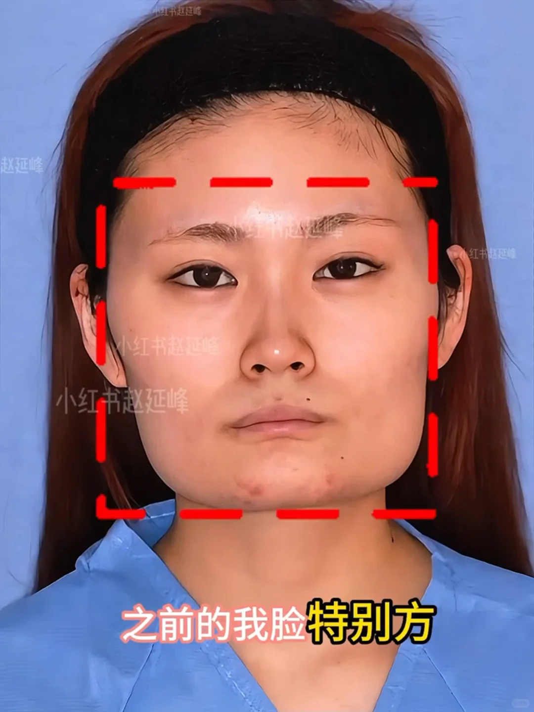 知道脸型重要，但没想到这么重要…