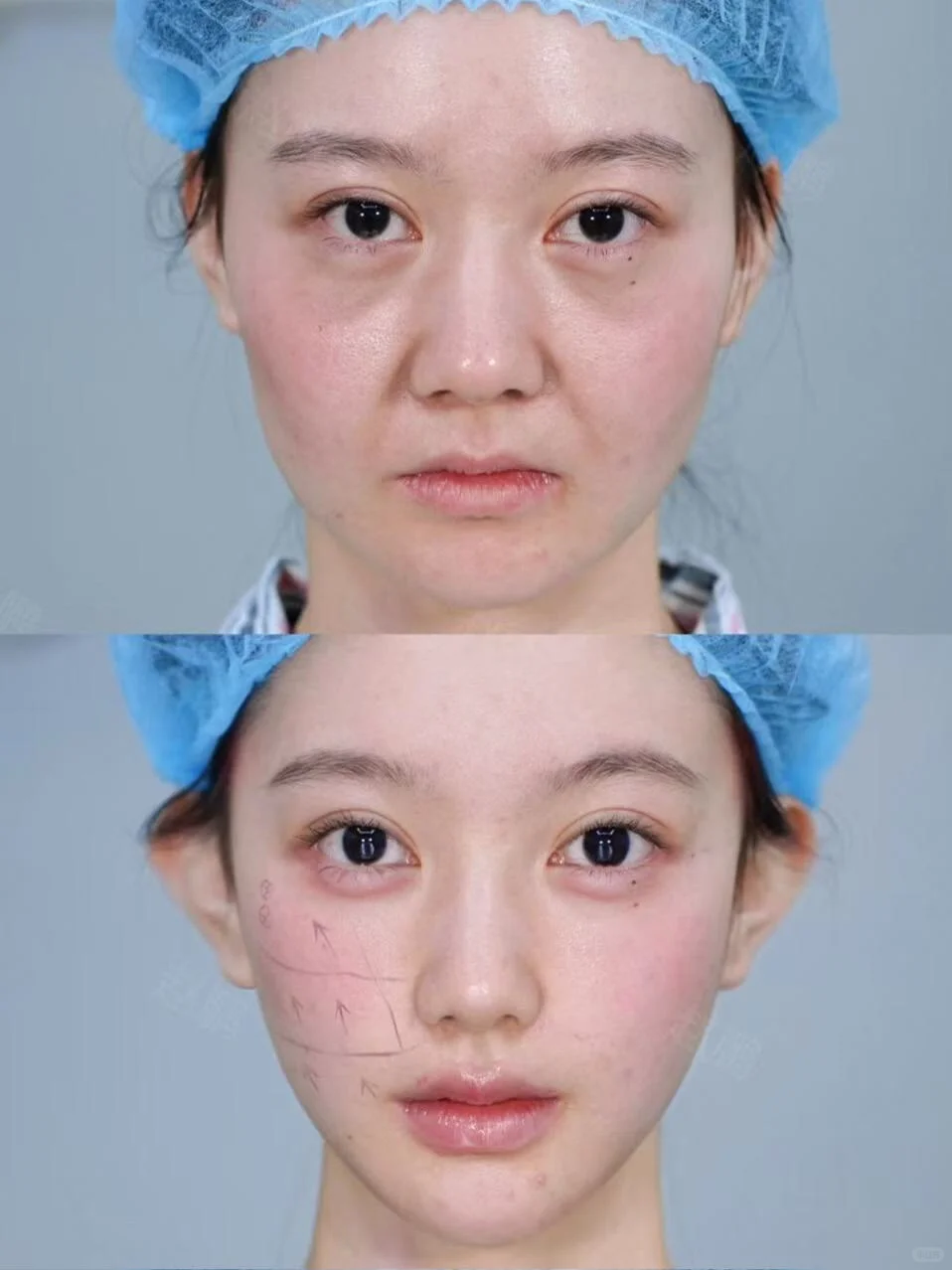 最具备性价比方案